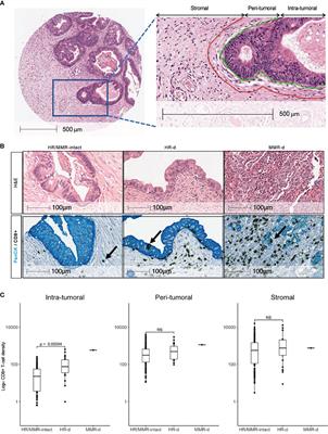 Intra-Tumoral CD8+ T-Cell Infiltration and PD-L1 Positivity in Homologous Recombination Deficient Pancreatic Ductal Adenocarcinoma